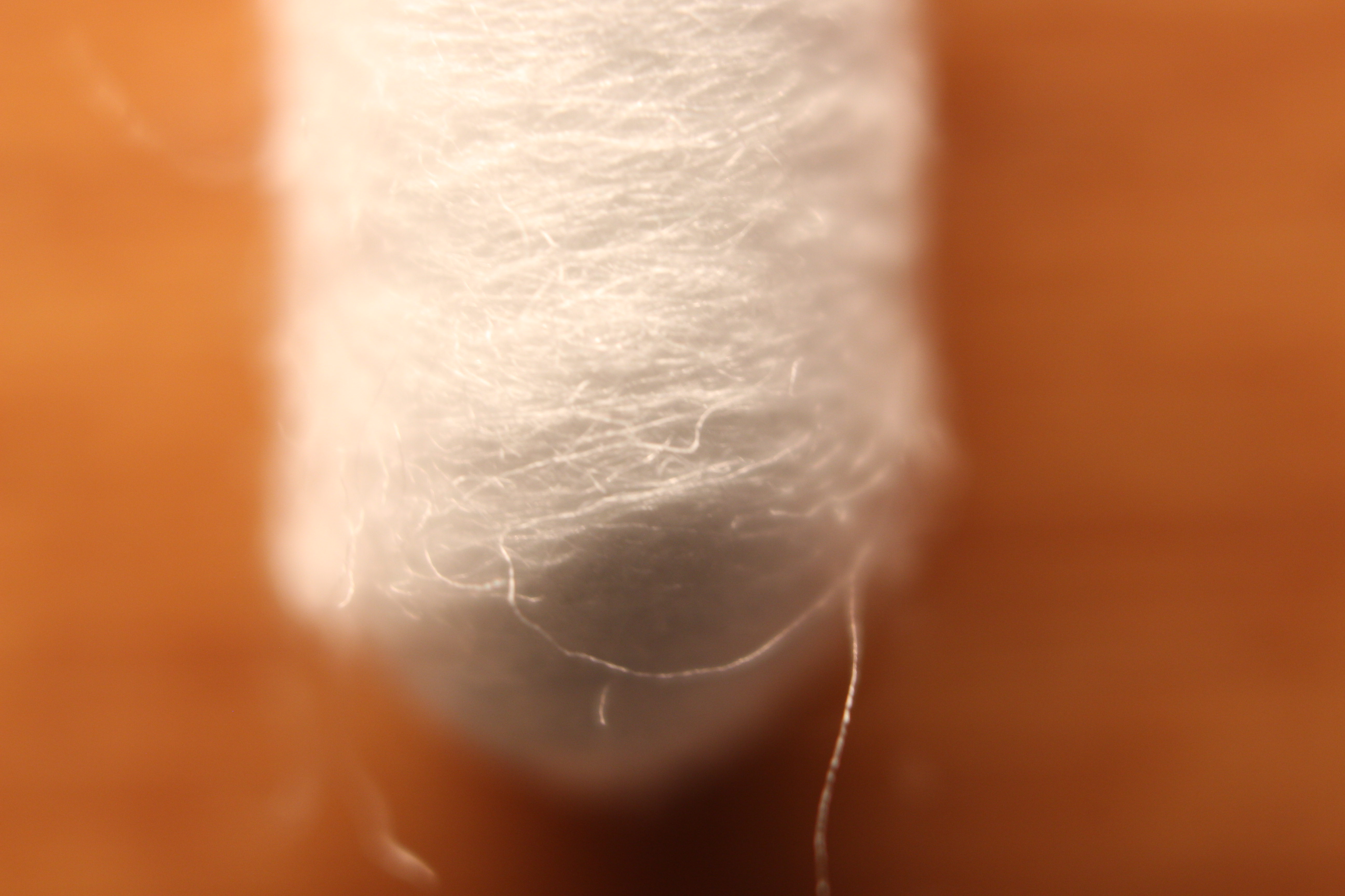 Macro and Micro Picture of the Day 2020-02-04