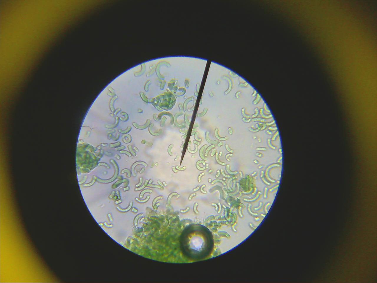 Macro and Micro Picture of the Day 2020-03-08