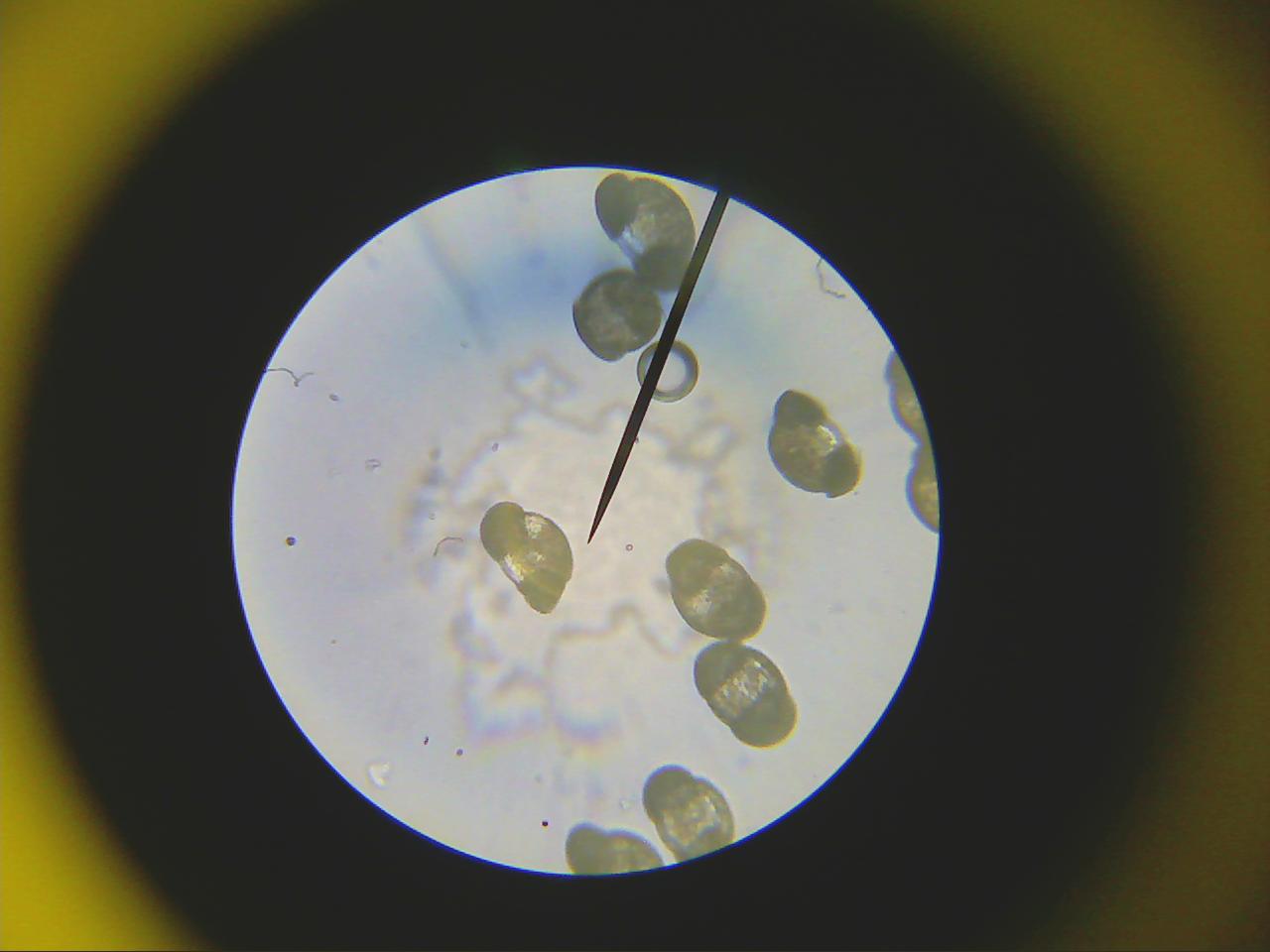 Macro and Micro Picture of the Day 2020-03-09