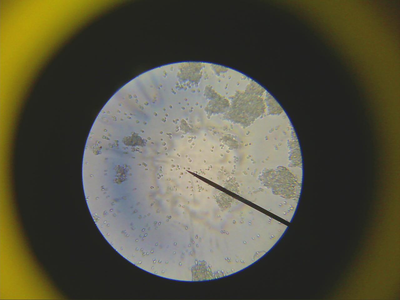 Macro and Micro Picture of the Day 2020-03-10