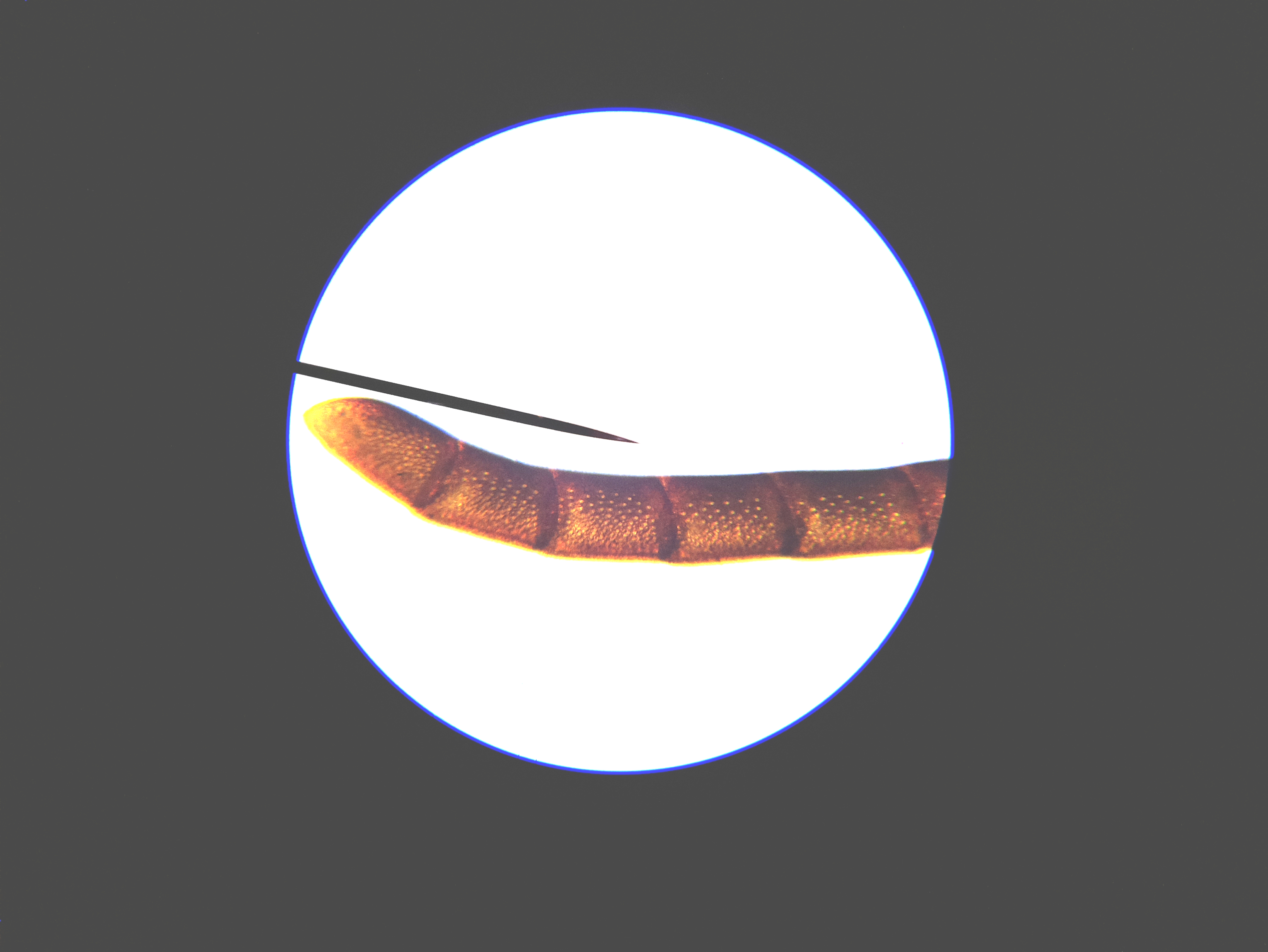 Macro and Micro Picture of the Day 2020-04-12