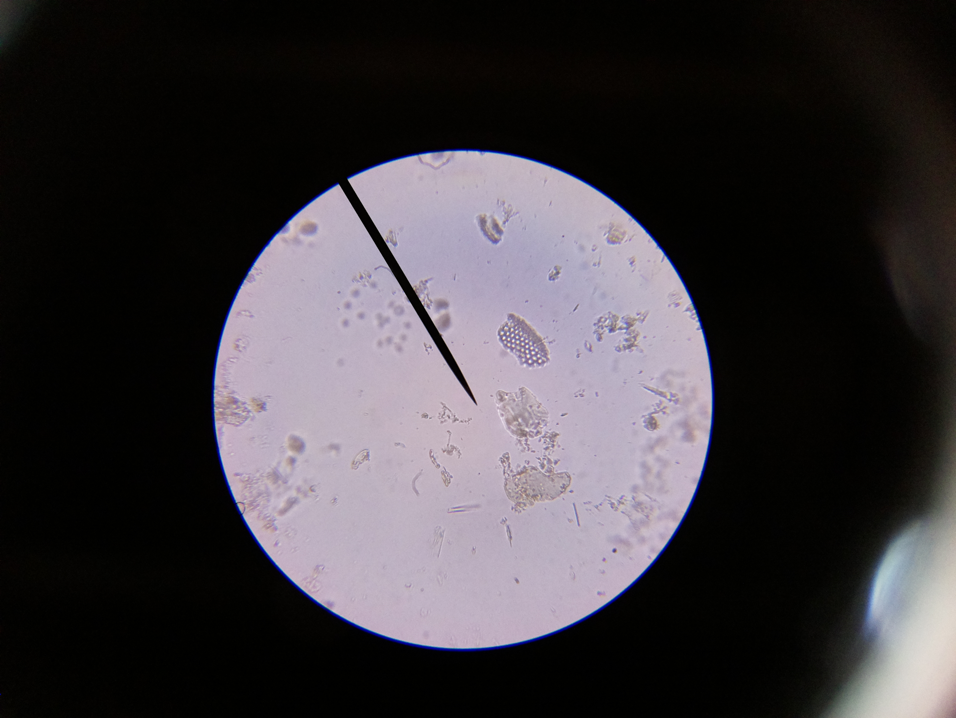 Macro and Micro Picture of the Day 2020-04-27