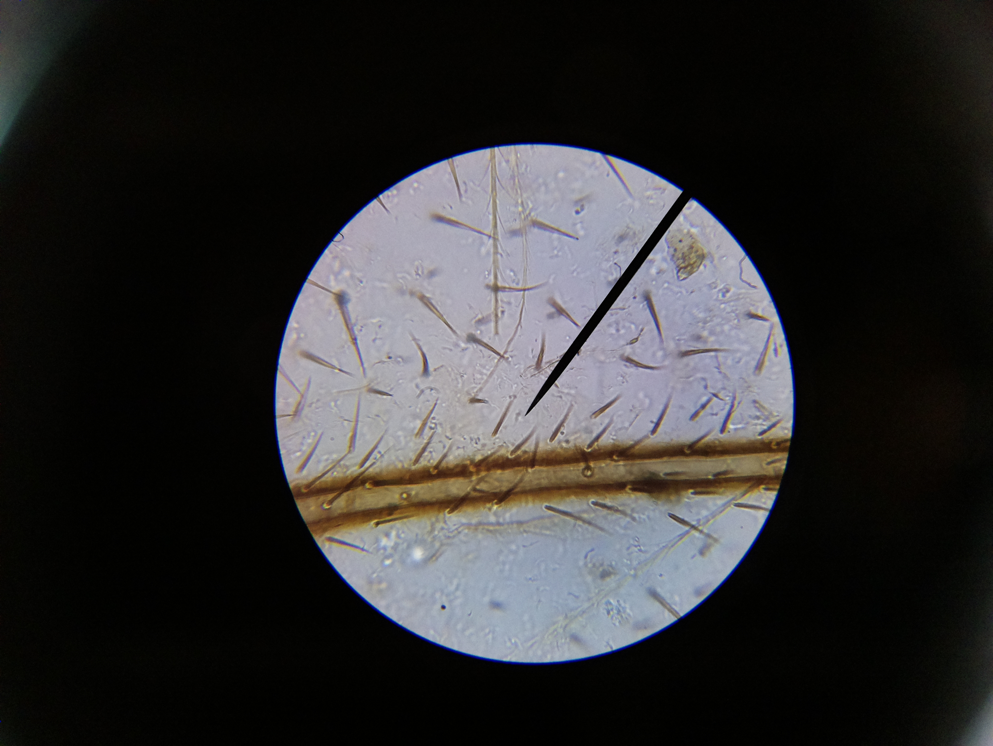 Macro and Micro Picture of the Day 2020-05-18