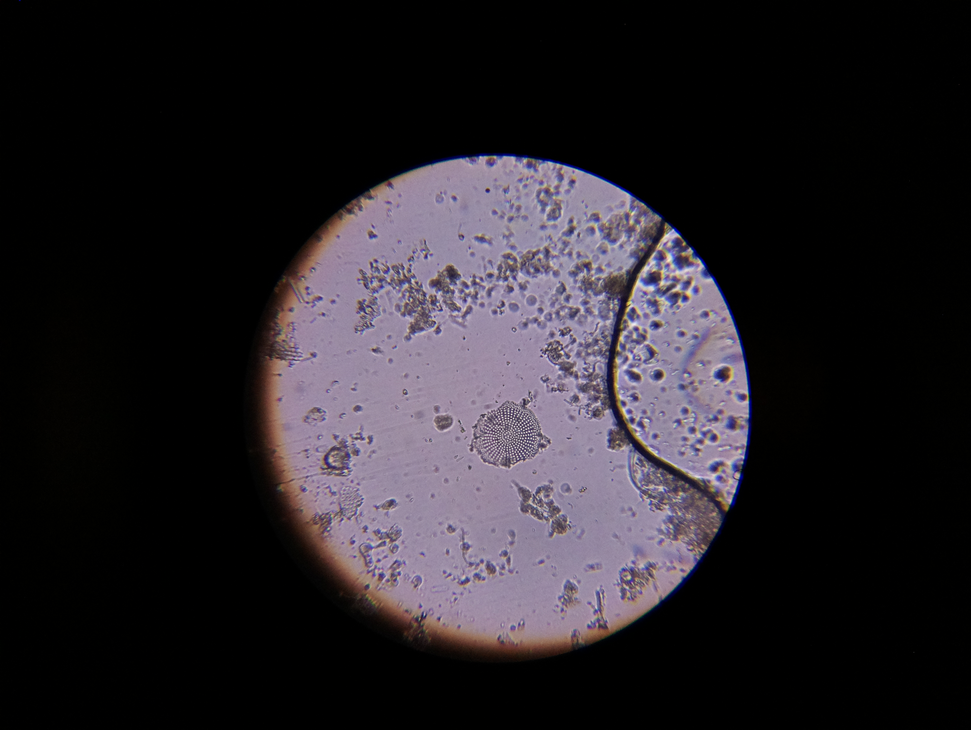 Macro and Micro Picture of the Day 2020-05-26