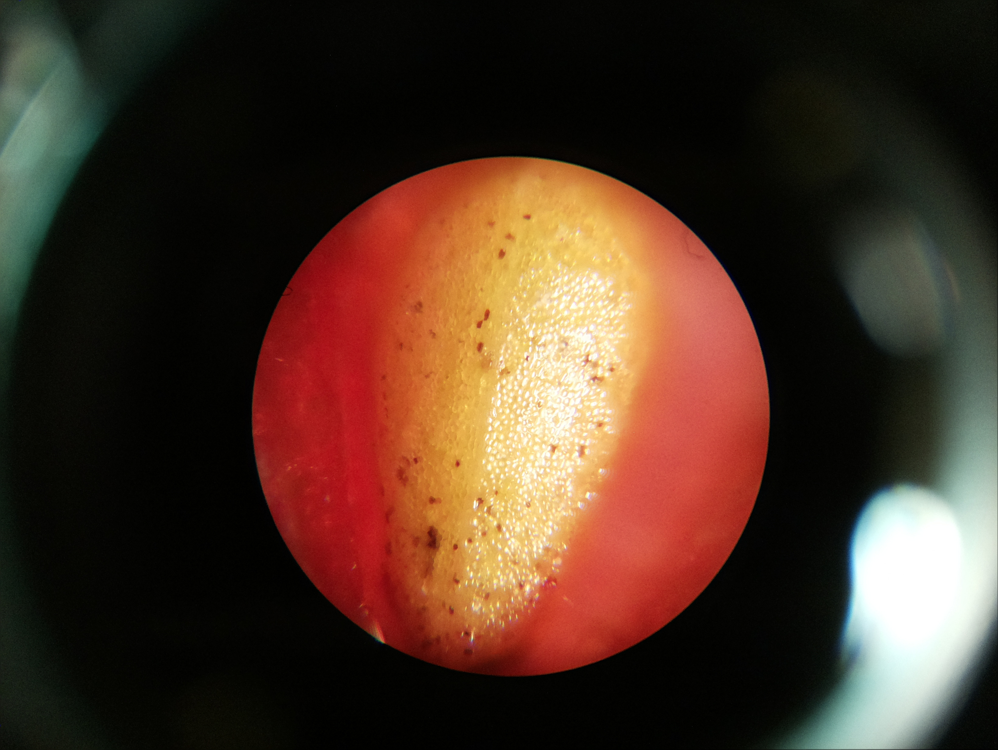 Macro and Micro Picture of the Day 2020-05-29