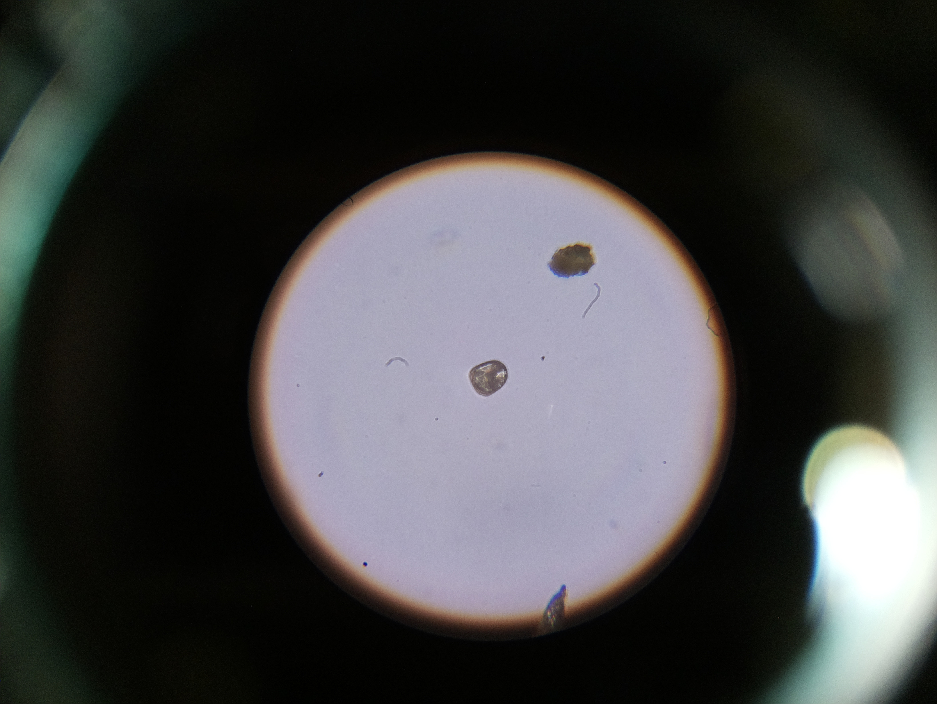 Macro and Micro Picture of the Day 2020-05-30