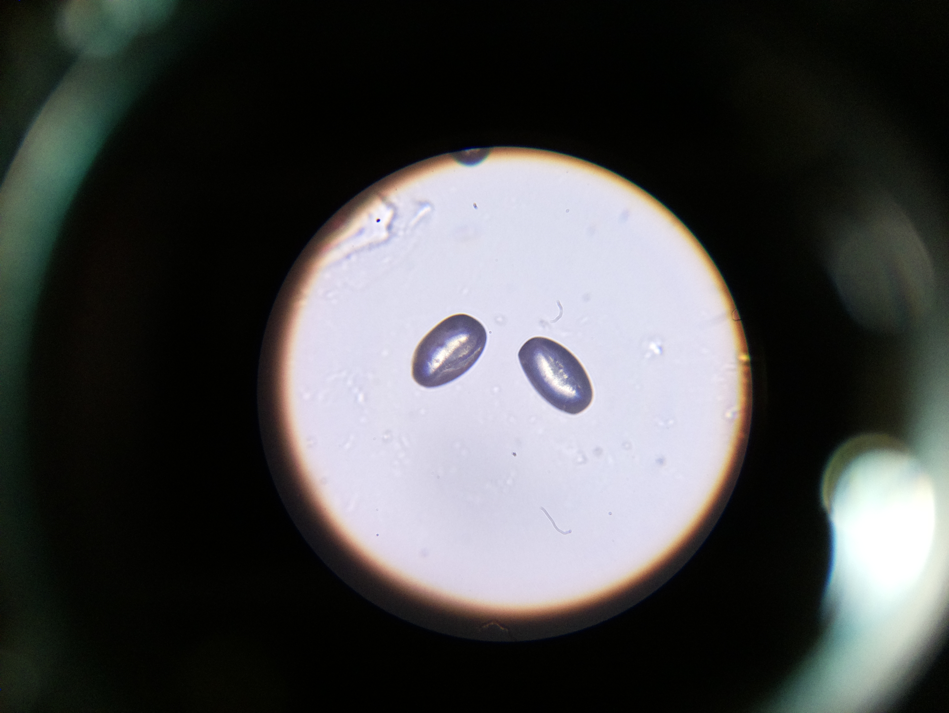 Macro and Micro Picture of the Day 2020-06-10