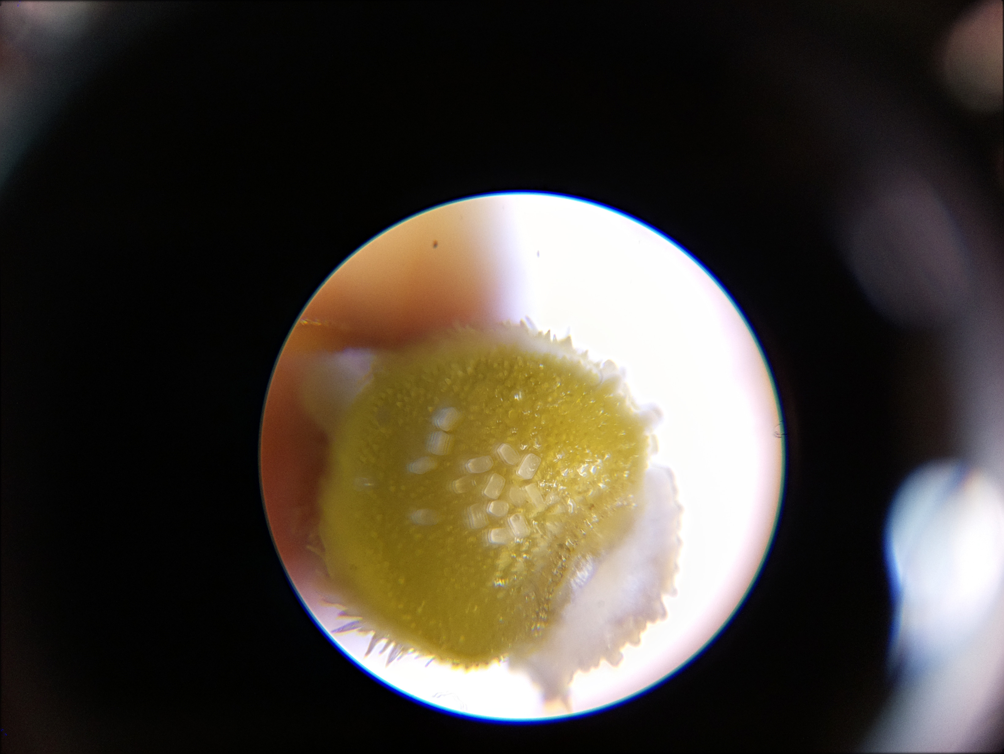 Macro and Micro Picture of the Day 2020-06-11