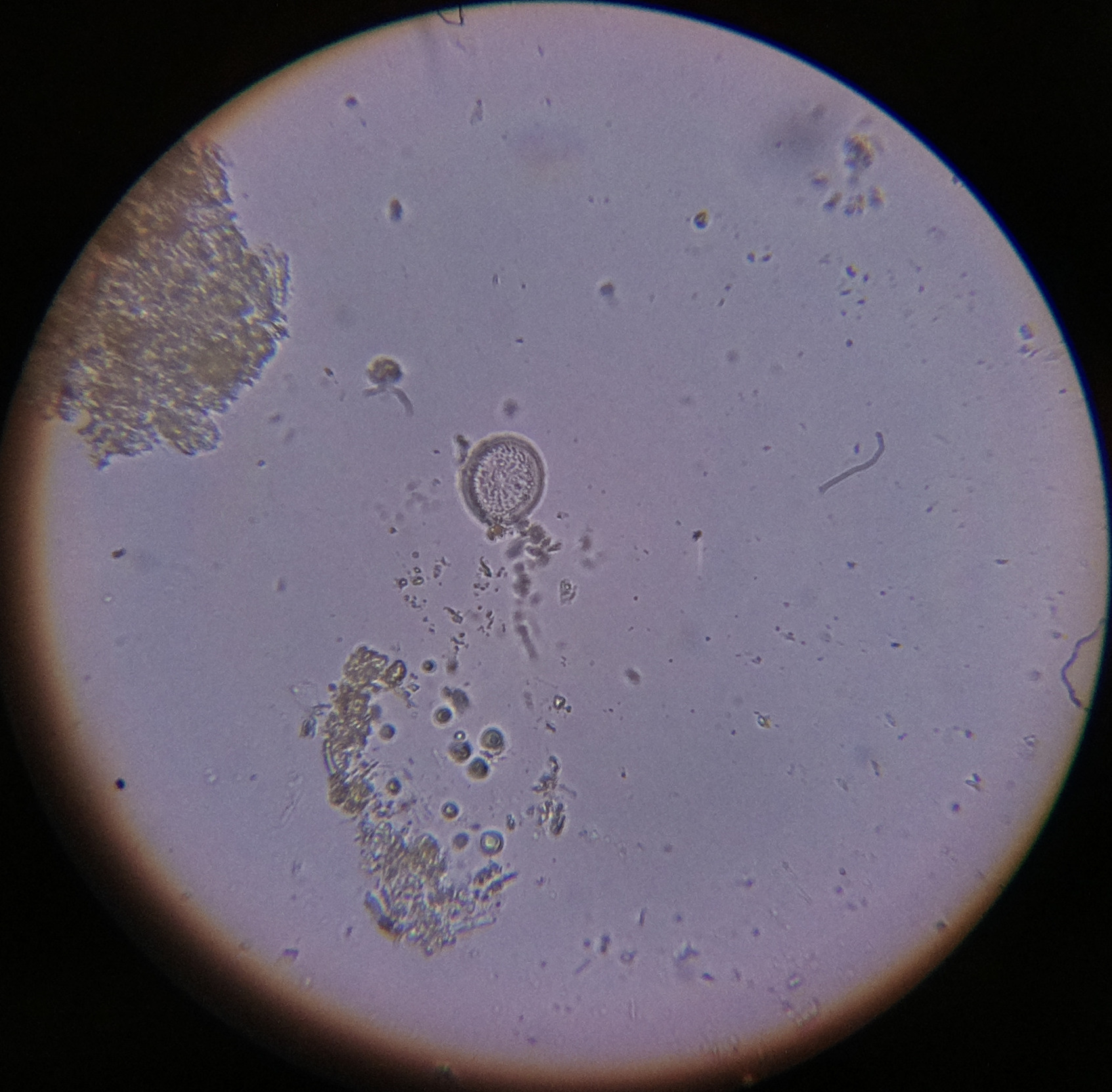 Macro and Micro Picture of the Day 2020-07-10