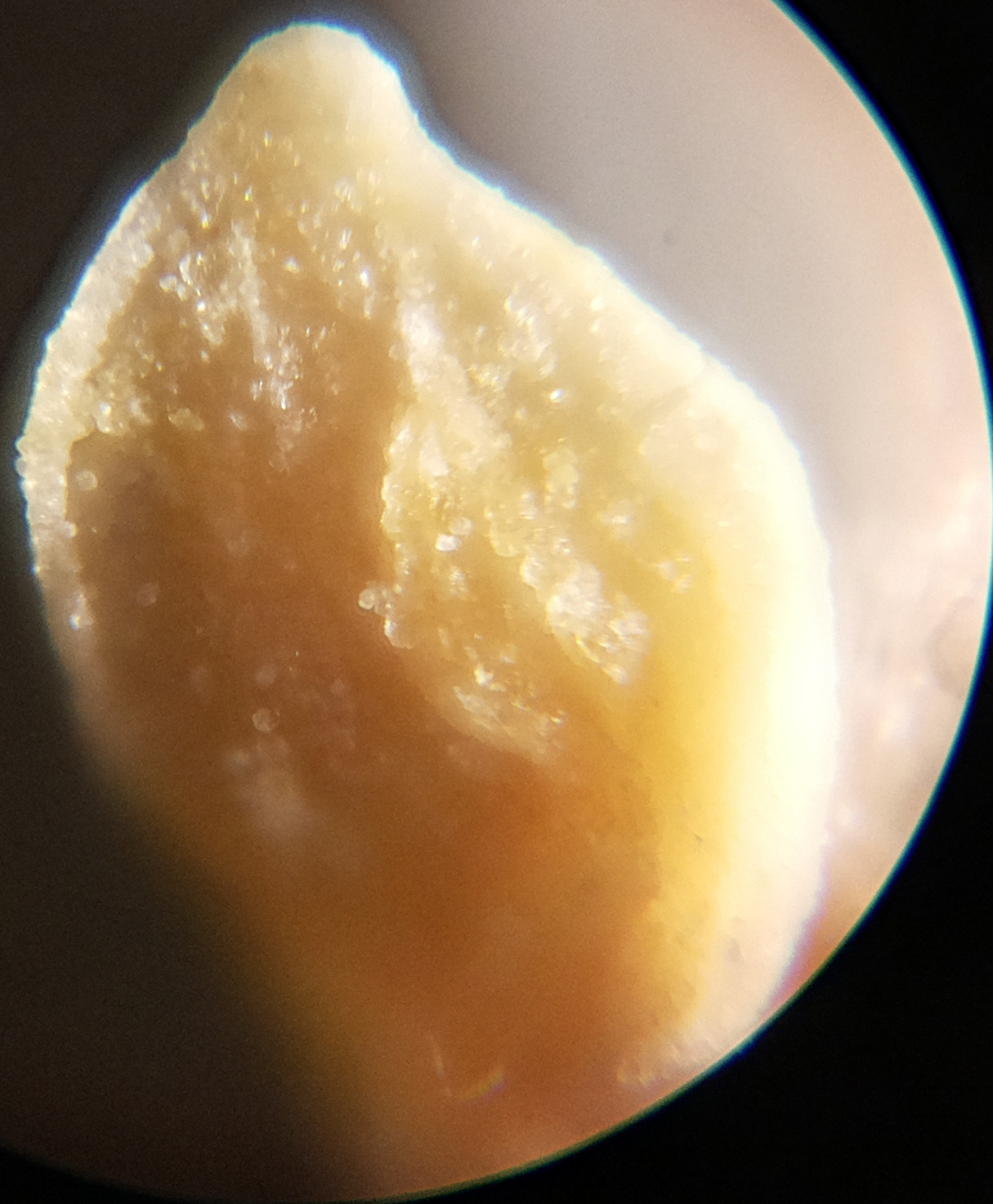 Macro and Micro Picture of the Day 2020-07-11