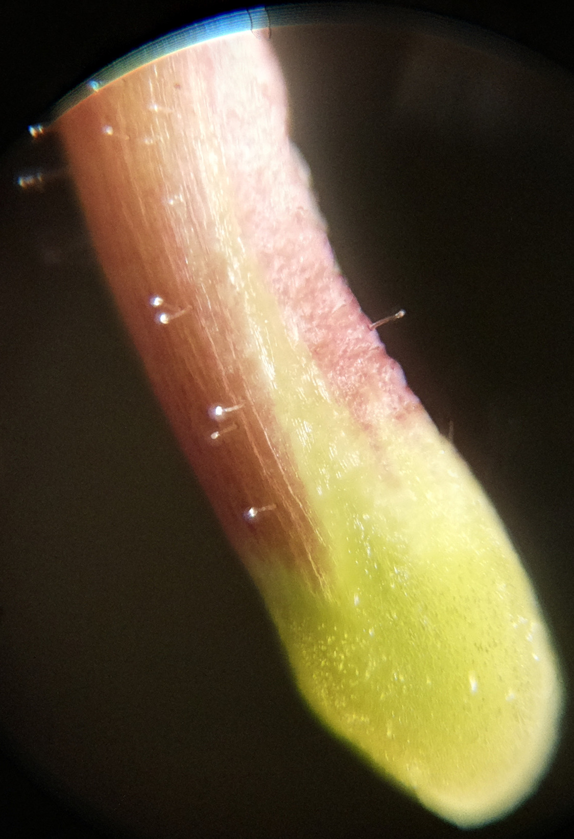 Macro and Micro Picture of the Day 2020-07-12