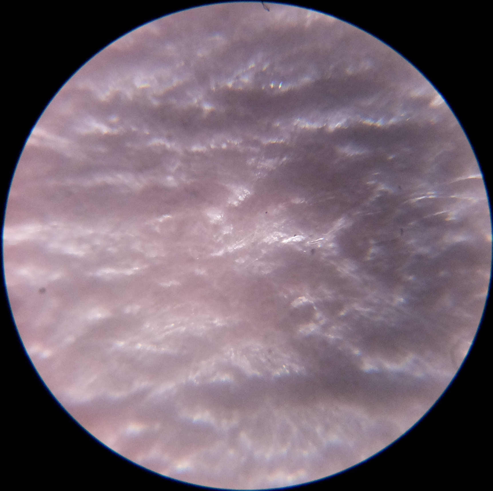 Macro and Micro Picture of the Day 2020-08-03