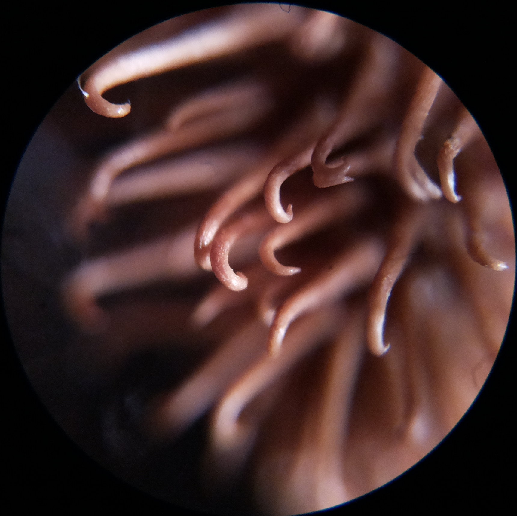 Macro and Micro Picture of the Day 2020-09-23