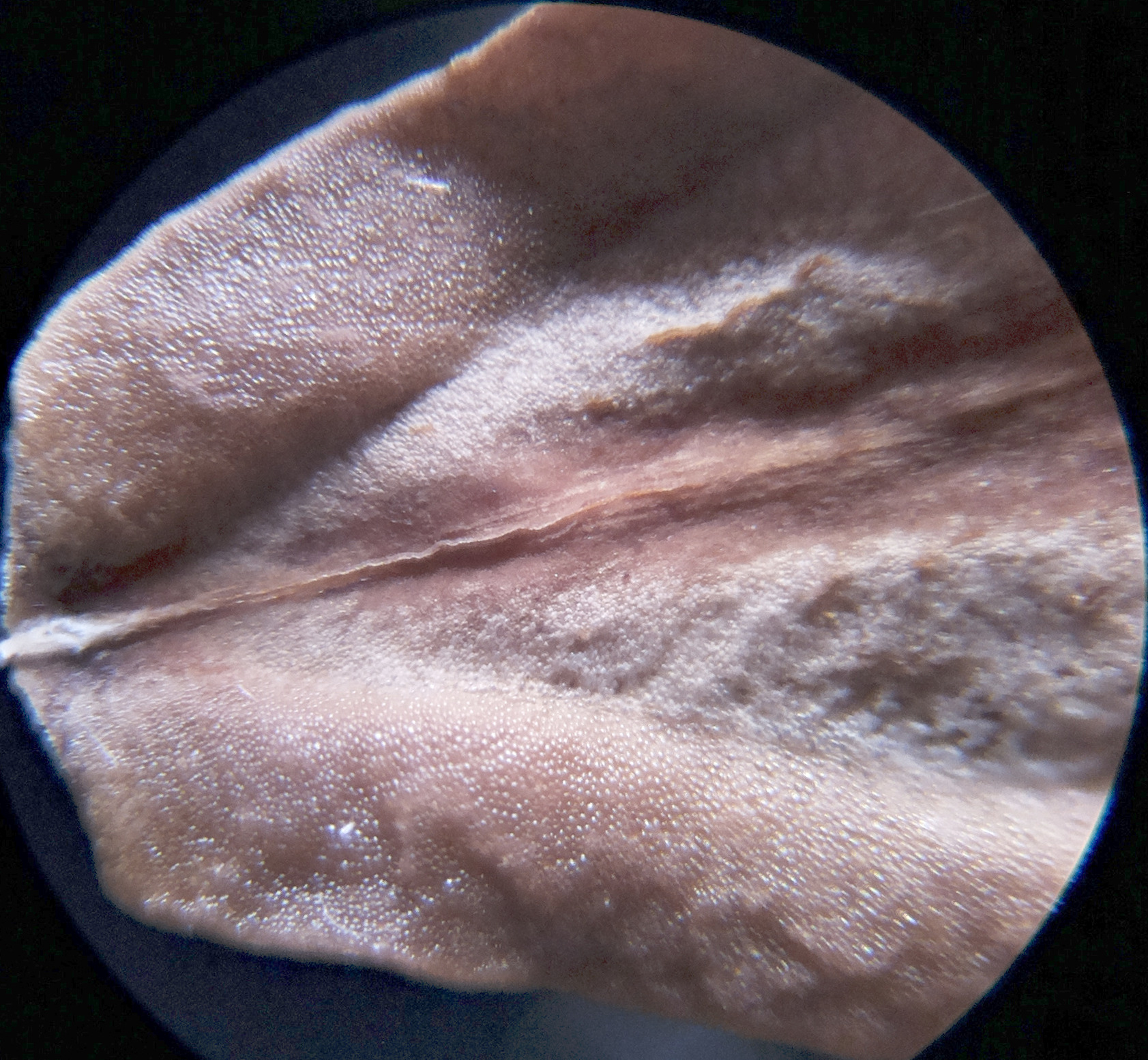 Macro and Micro Picture of the Day 2020-09-24