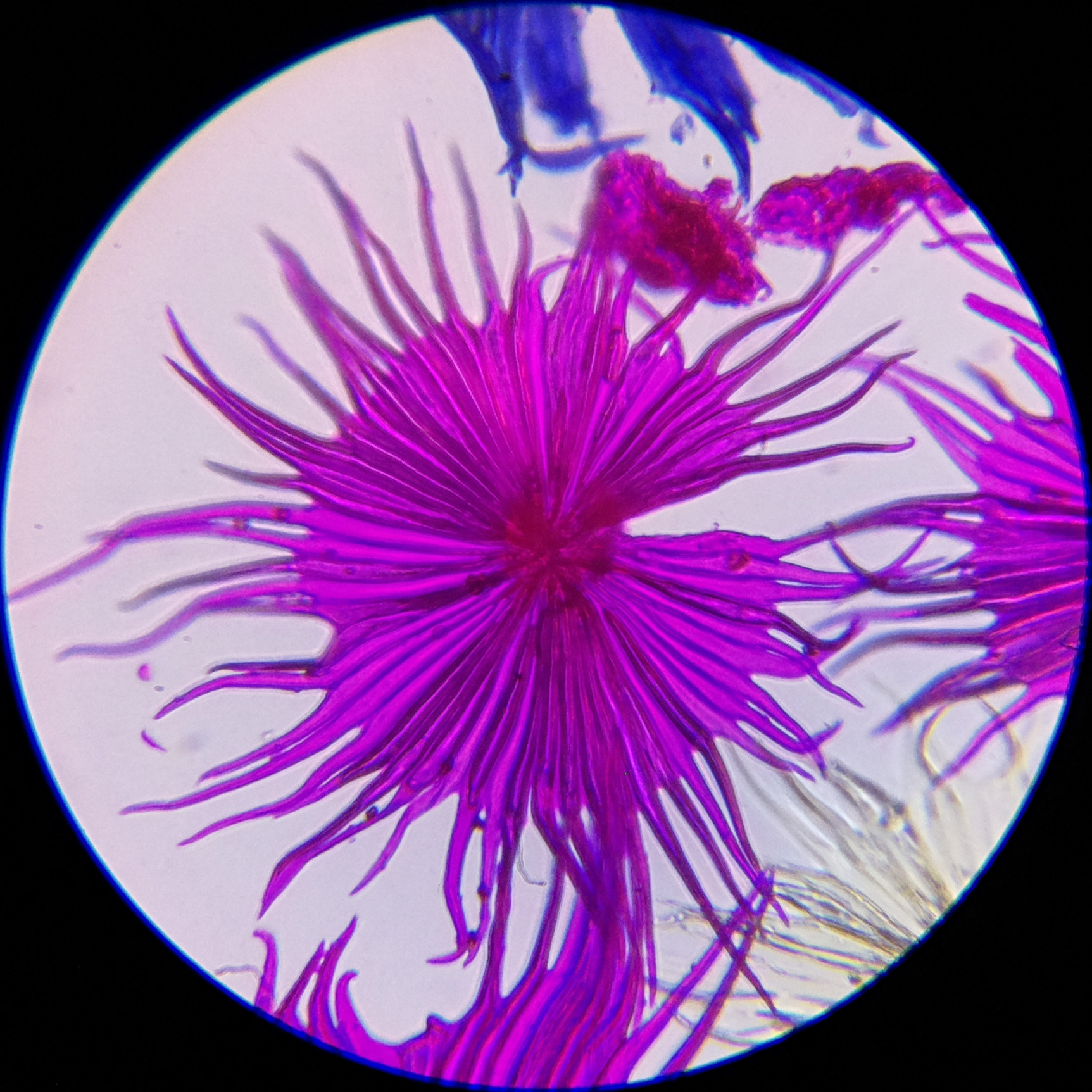 Macro and Micro Picture of the Day 2020-10-05