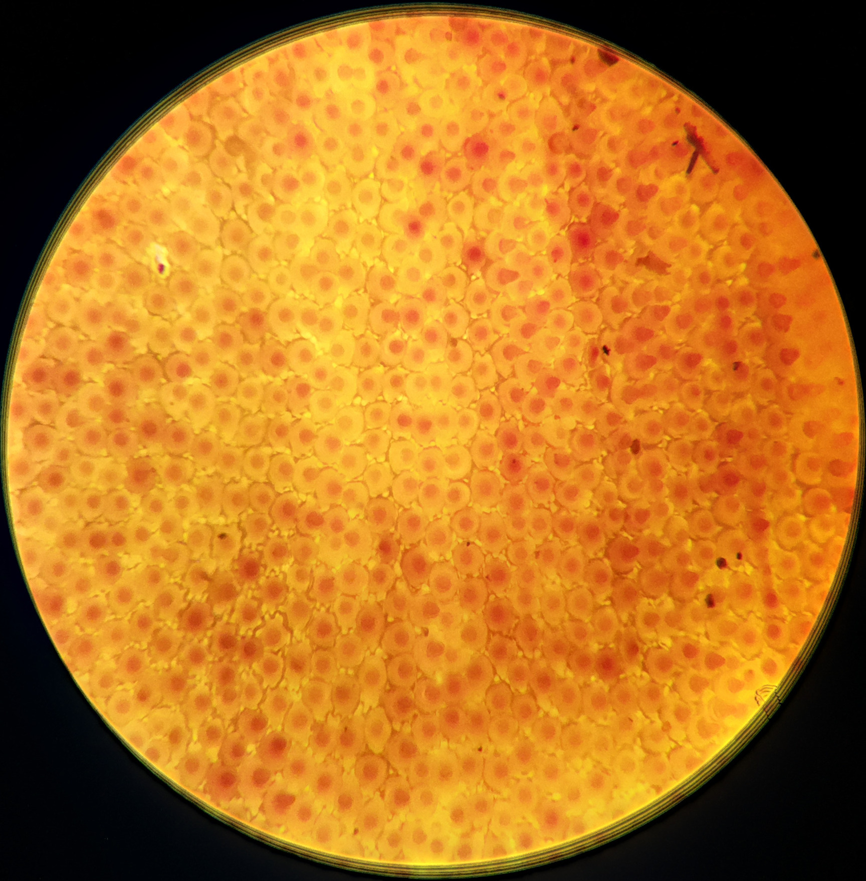 Macro and Micro Picture of the Day 2020-10-07