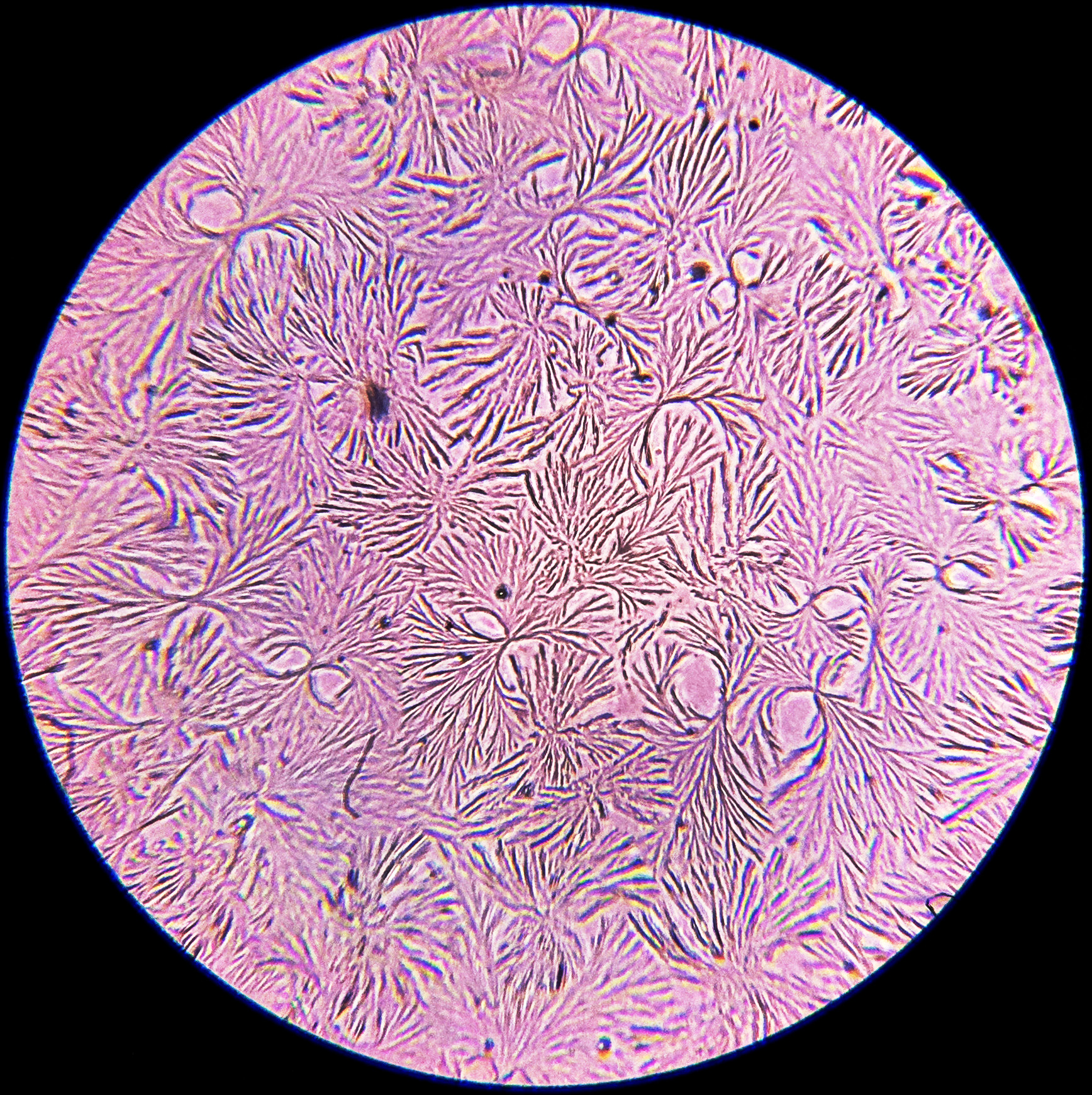 Macro and Micro Picture of the Day 2020-10-31